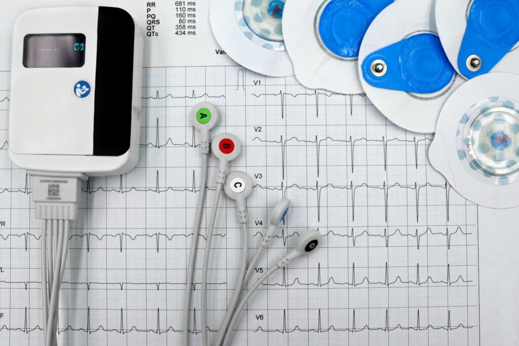 Close-up of ECG device with leads and electrodes on printed heart rate graph, showcasing medical technology.